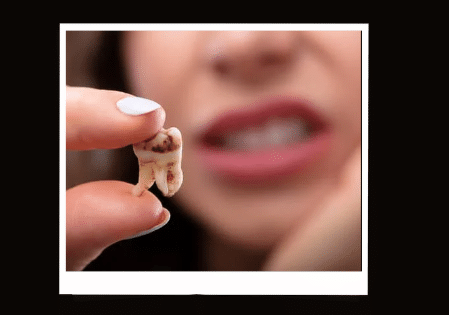 mơ rụng răng đánh con gì